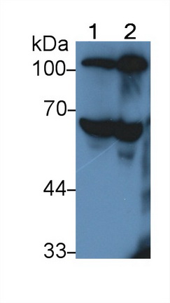 Polyclonal Antibody to Antithrombin (AT)