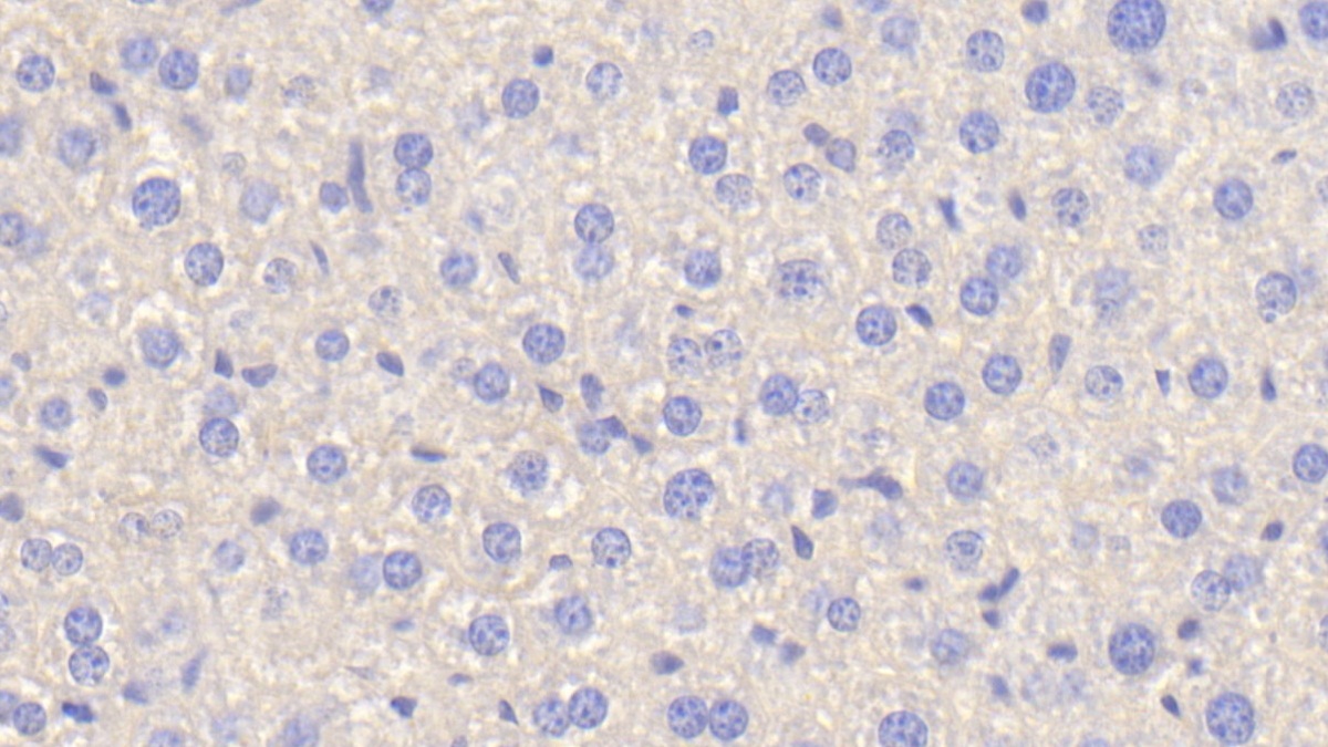 Polyclonal Antibody to Antithrombin (AT)