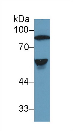 Polyclonal Antibody to Antithrombin (AT)