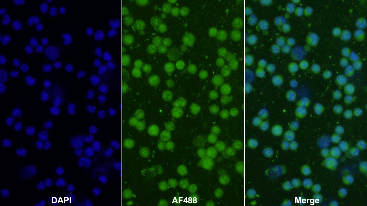 Polyclonal Antibody to Bcl6 Corepressor (BCOR)
