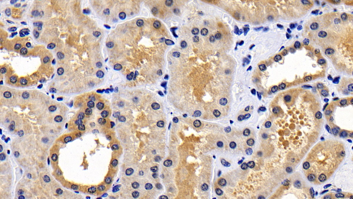 Polyclonal Antibody to Bcl2 Associated Death Promoter (BAD)