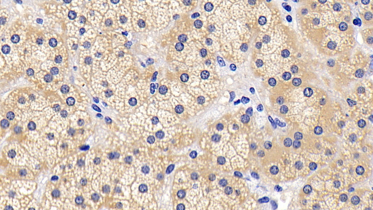 Polyclonal Antibody to Bcl2 Associated Death Promoter (BAD)