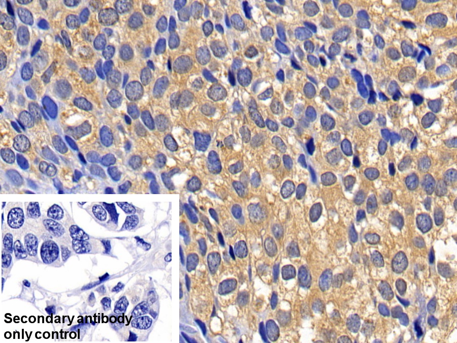 Polyclonal Antibody to Caspase 6 (CASP6)