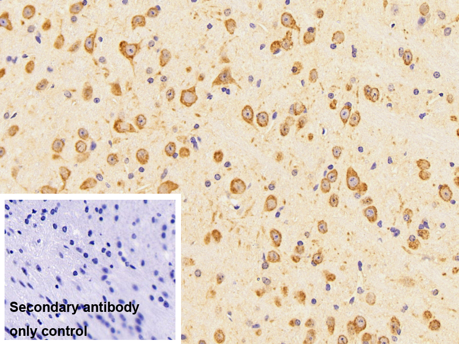 Polyclonal Antibody to Heat Shock 70kDa Protein 5 (HSPA5)