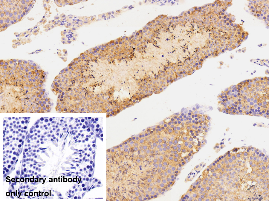 Polyclonal Antibody to Heat Shock 70kDa Protein 5 (HSPA5)