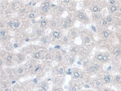 Polyclonal Antibody to Butyrylcholinesterase (BCHE)