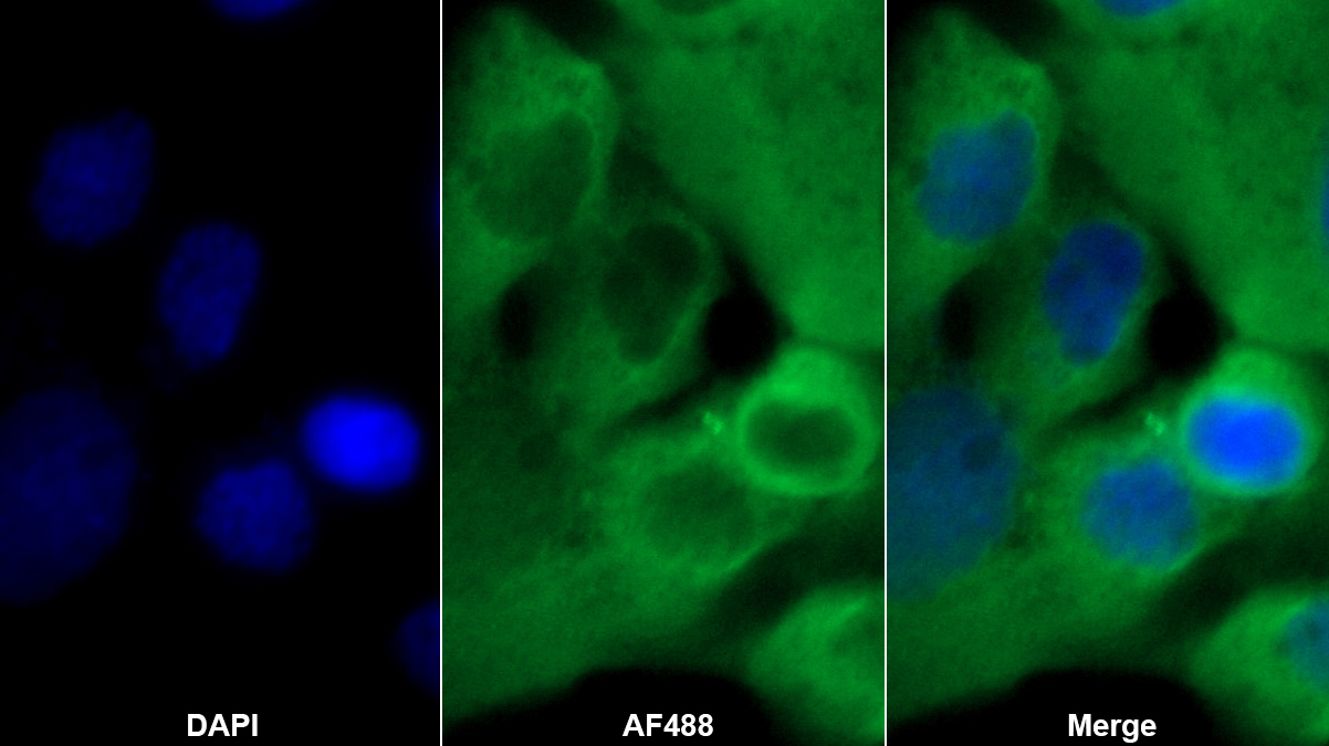 Polyclonal Antibody to Calcyclin Binding Protein (CACYBP)