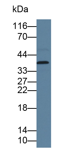 Polyclonal Antibody to Calcium Modulating Ligand (CAMLG)