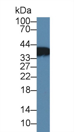 Polyclonal Antibody to Calcium Modulating Ligand (CAMLG)