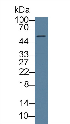 Polyclonal Antibody to Calcium Activated Nucleotidase 1 (CANT1)