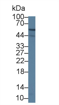 Polyclonal Antibody to Calcium Activated Nucleotidase 1 (CANT1)