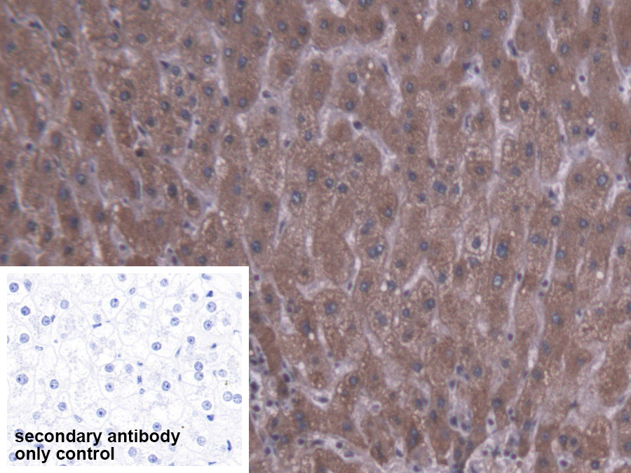 Polyclonal Antibody to Carboxylesterase 1 (CES1)