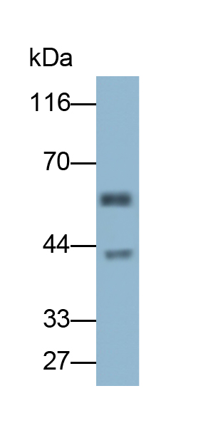 Polyclonal Antibody to Carboxylesterase 1 (CES1)