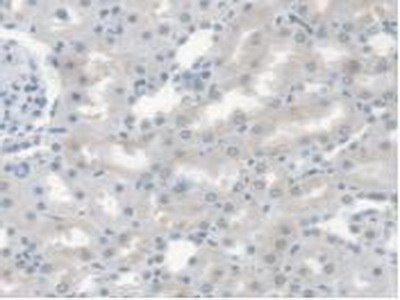 Polyclonal Antibody to Carboxylesterase 1 (CES1)