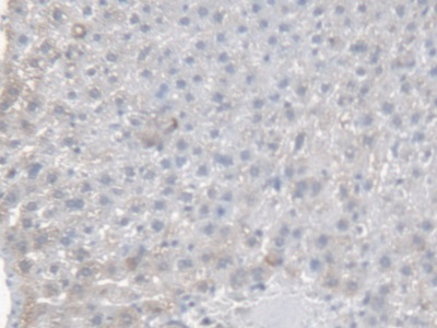 Polyclonal Antibody to Carboxylesterase 1 (CES1)