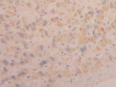 Polyclonal Antibody to Cardiotrophin Like Cytokine Factor 1 (CLCF1)