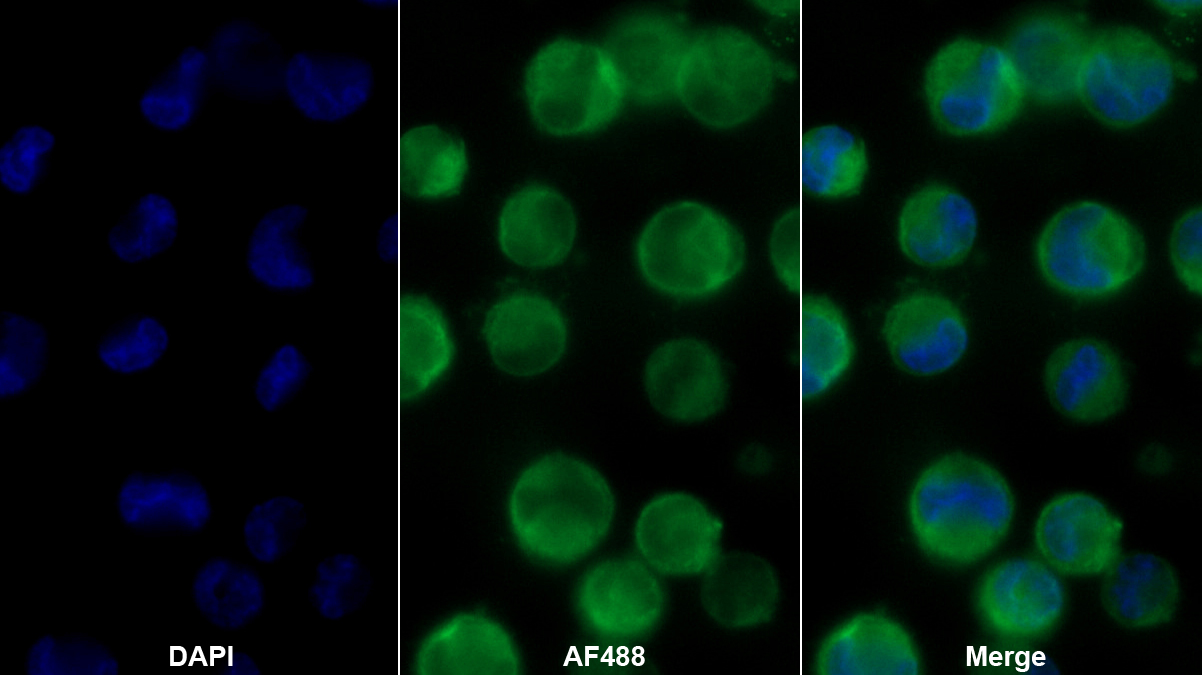 Polyclonal Antibody to Chloride Intracellular Channel Protein 1 (CLIC1)