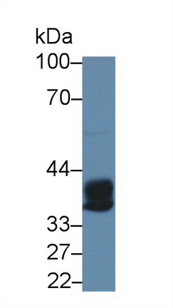 Polyclonal Antibody to Carboxypeptidase A3 (CPA3)