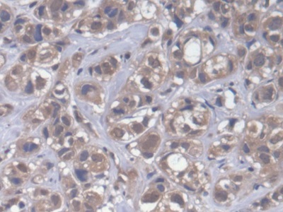 Polyclonal Antibody to Cytoplasmic Polyadenylation Element Binding Protein 1 (CPEB1)