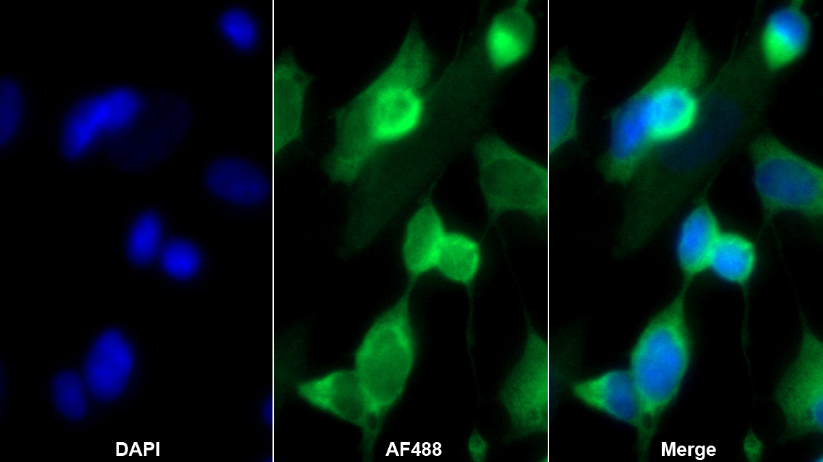 Polyclonal Antibody to Collapsin Response Mediator Protein 1 (CRMP1)