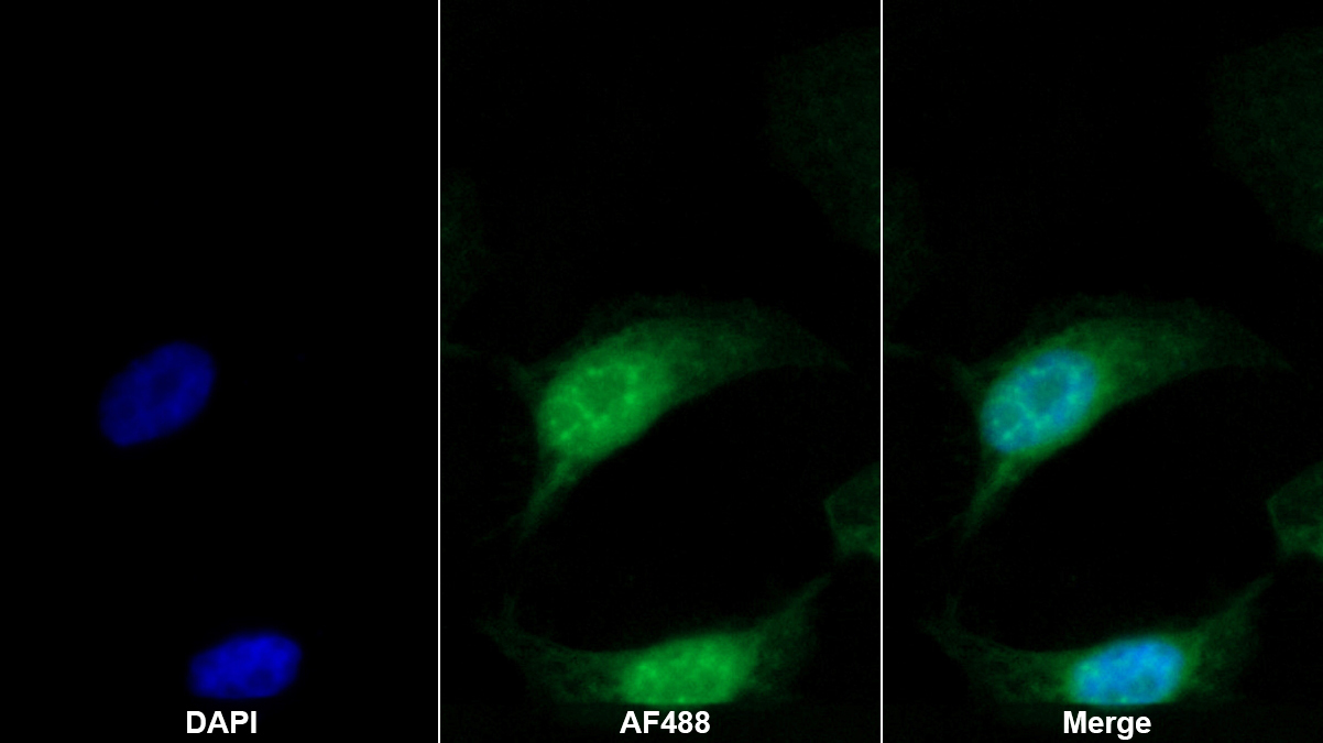 Polyclonal Antibody to Cisplatin Resistance Associated Overexpressed Protein (CROP)