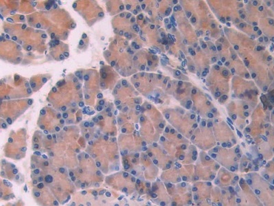 Polyclonal Antibody to Cubilin (CUBN)