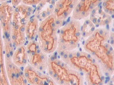 Polyclonal Antibody to Cubilin (CUBN)