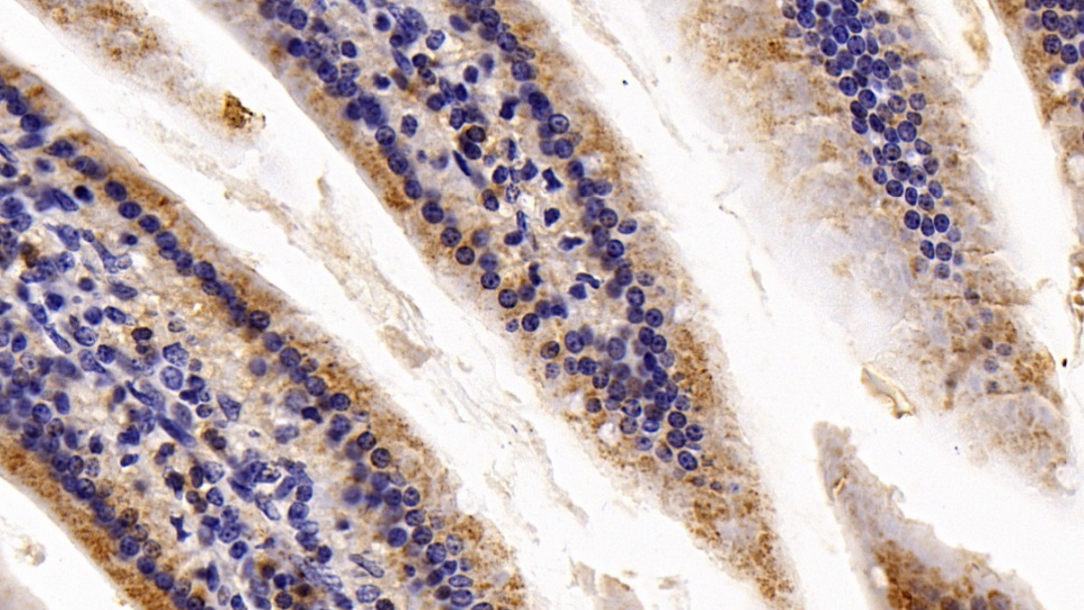 Polyclonal Antibody to Catalase (CAT)