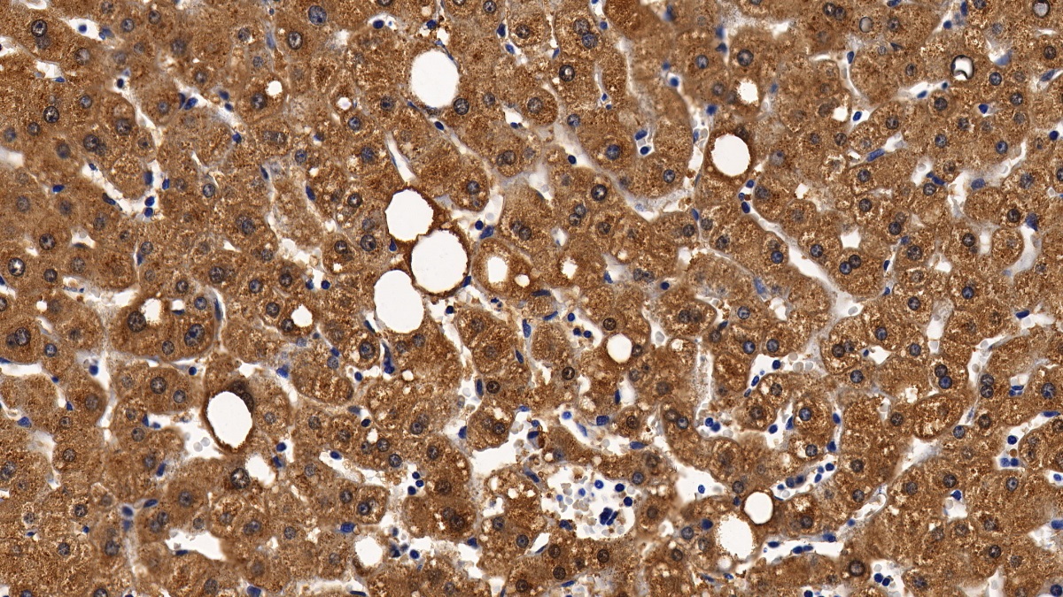 Polyclonal Antibody to Catalase (CAT)