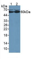 Polyclonal Antibody to Catalase (CAT)