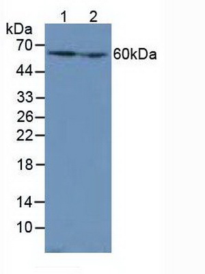 Polyclonal Antibody to Catalase (CAT)