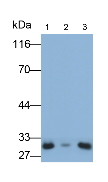 Polyclonal Antibody to Deoxycytidine Kinase (DCK)