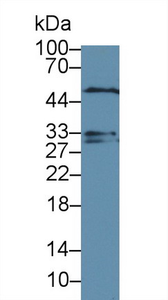 Polyclonal Antibody to Dystrobrevin Binding Protein 1 (DTNBP1)