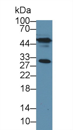 Polyclonal Antibody to Dystrobrevin Binding Protein 1 (DTNBP1)