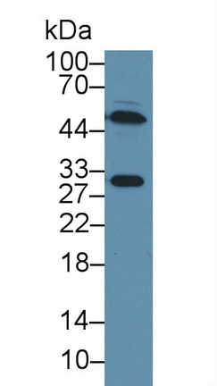 Polyclonal Antibody to Dystrobrevin Binding Protein 1 (DTNBP1)