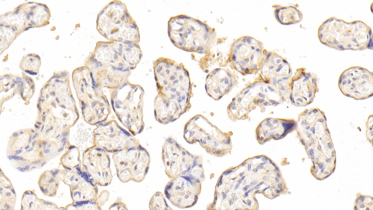 Polyclonal Antibody to Dysferlin (DYSF)