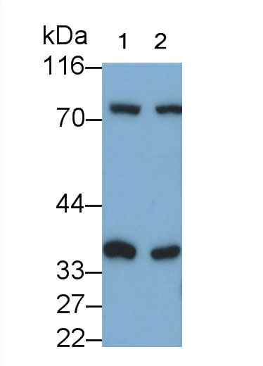 Polyclonal Antibody to Epithelial Cell Transforming Sequence 2 (ECT2)