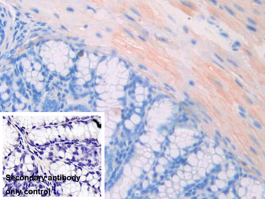 Polyclonal Antibody to Epithelial Cell Transforming Sequence 2 (ECT2)