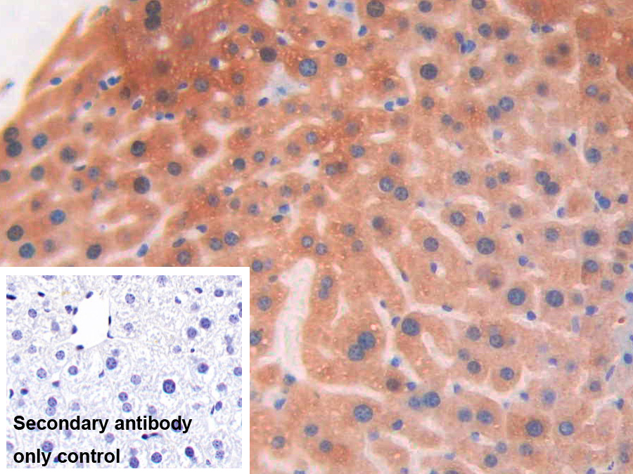 Polyclonal Antibody to Epithelial Cell Transforming Sequence 2 (ECT2)