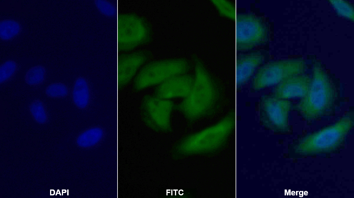 Polyclonal Antibody to Eukaryotic Translation Elongation Factor 2 (EEF2)