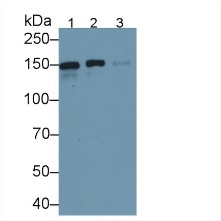 Polyclonal Antibody to Endoplasmic Reticulum To Nucleus Signalling 1 (ERN1)