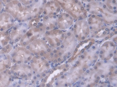 Polyclonal Antibody to Endoplasmic Reticulum Protein 29 (ERP29)