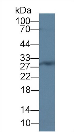 Polyclonal Antibody to CCAAT/Enhancer Binding Protein Delta (CEBPd)