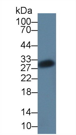 Polyclonal Antibody to CCAAT/Enhancer Binding Protein Delta (CEBPd)