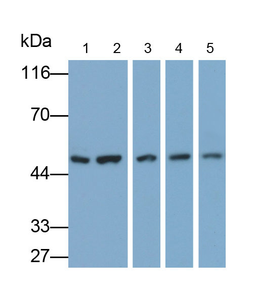 Polyclonal Antibody to CCAAT/Enhancer Binding Protein Delta (CEBPd)