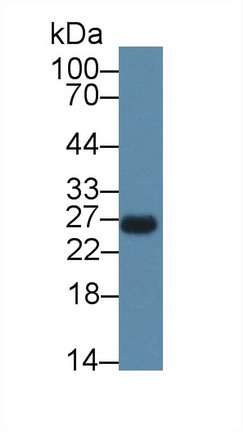 Polyclonal Antibody to CCAAT/Enhancer Binding Protein Delta (CEBPd)