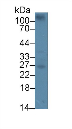 Polyclonal Antibody to CCAAT/Enhancer Binding Protein Delta (CEBPd)