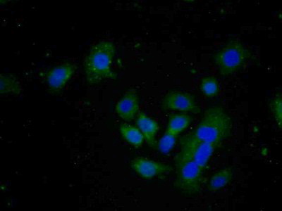 Polyclonal Antibody to Fibroblast Activation Protein Alpha (FAPa)