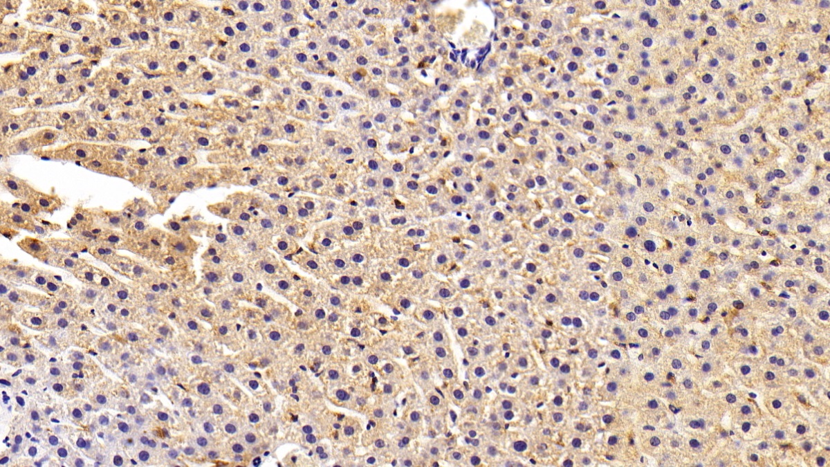 Polyclonal Antibody to Fatty Acid Synthase (FASN)