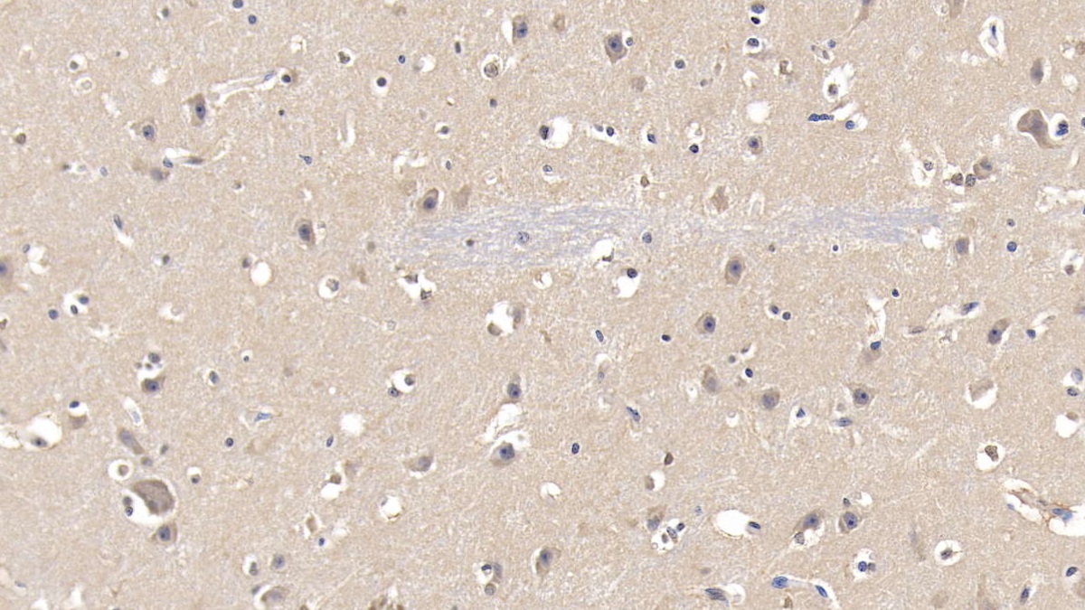 Polyclonal Antibody to Fatty Acid Synthase (FASN)